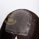 Frontales Implantados